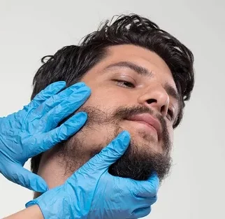 beard transplant in indore, best hair transplant clinic indore
